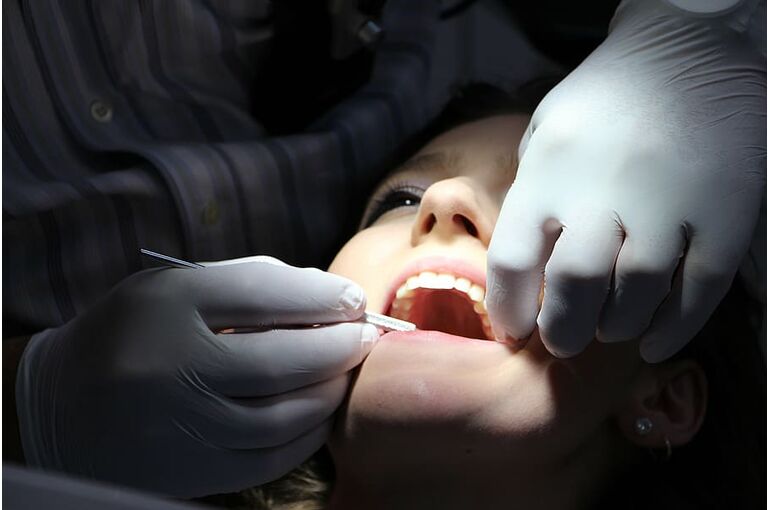 zahnreinigung-dental-repairs-treat-teeth-brushing-teeth