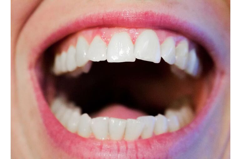 teeth-dentist-dental-mouth (1)