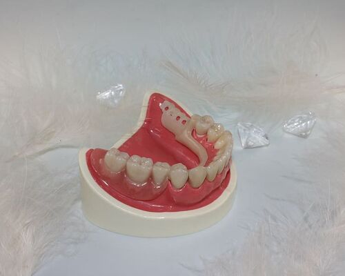 tooth-replacement-tooth-dental-technician (1)
