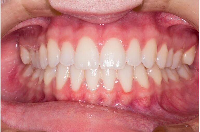 teeth-smile-dentist-human-teeth