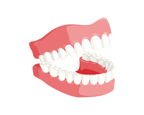 teeth-3414722_960_720