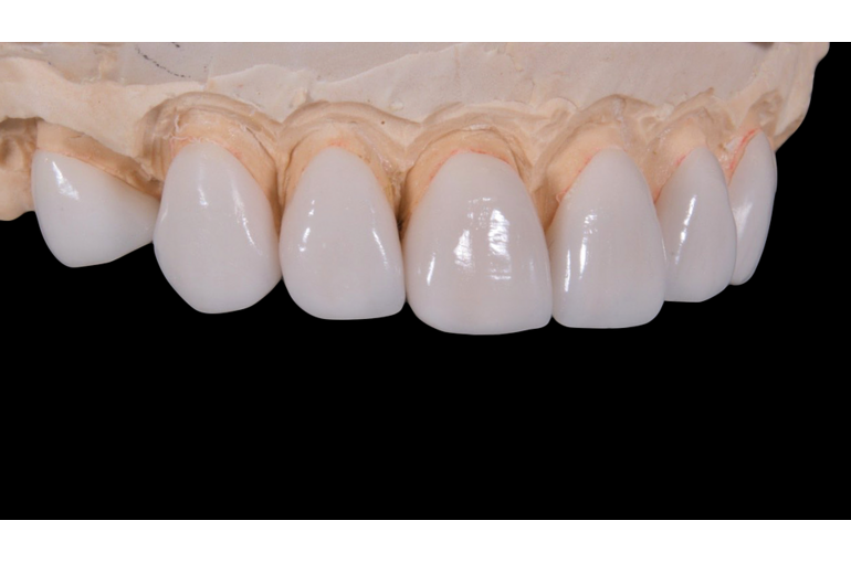 dental-2036945_960_720