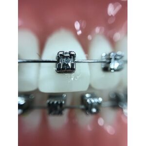 tooth-dentistry-fun-dentist